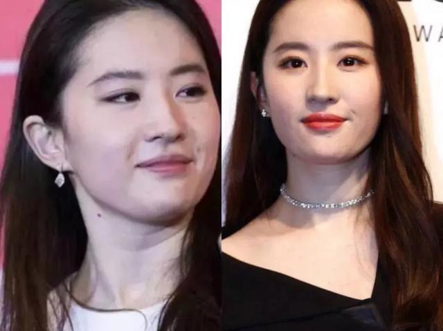 壹知肤脖子上的颈纹啊我该拿你怎么办