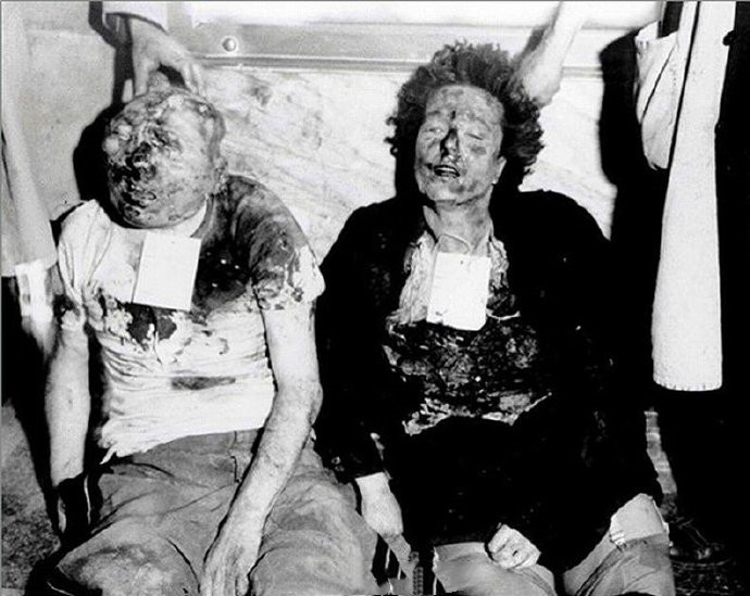 被打成猪头的墨索里尼横尸街头的德国女鬼子5张历史老照片