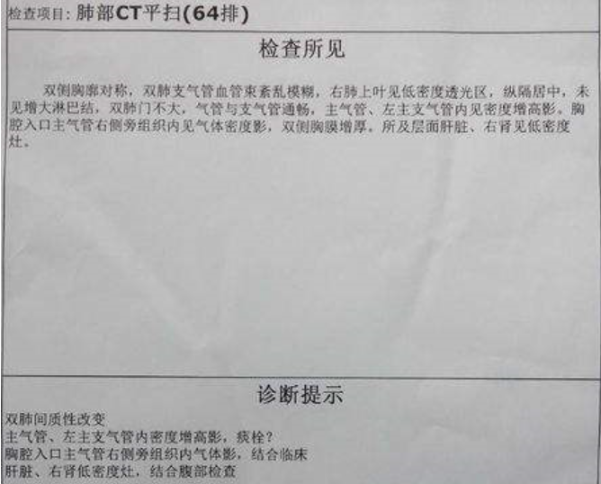 教你看体检报告——胸部ct/x光_腾讯新闻