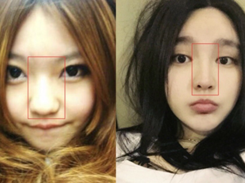 网传一组周扬青整容前后对比图