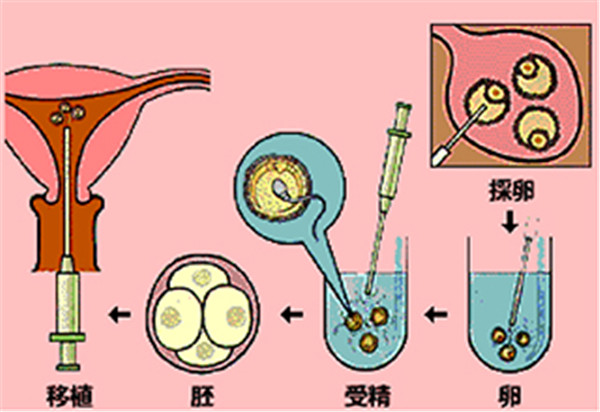 試管嬰兒移植後的胚胎或囊胚會自己掉出來麼