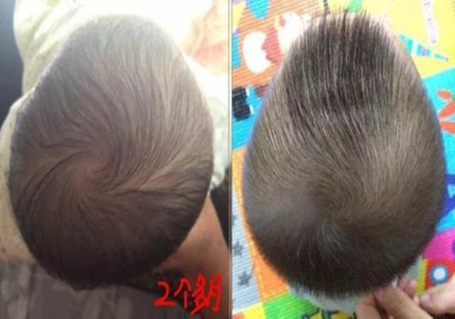 让孩子睡扁头还很得意?别再一错到底,不仅伤娃还影响颜值
