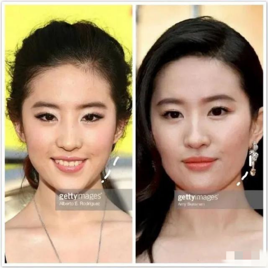 比发福更可怕的"发腮",连刘亦菲都难幸免,面部膨胀仙气不再