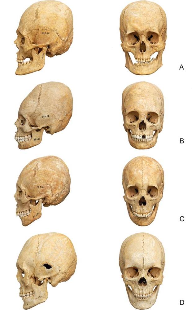 欧洲发现外星人头骨,最早至公元5世纪,见证罗马帝国兴衰!