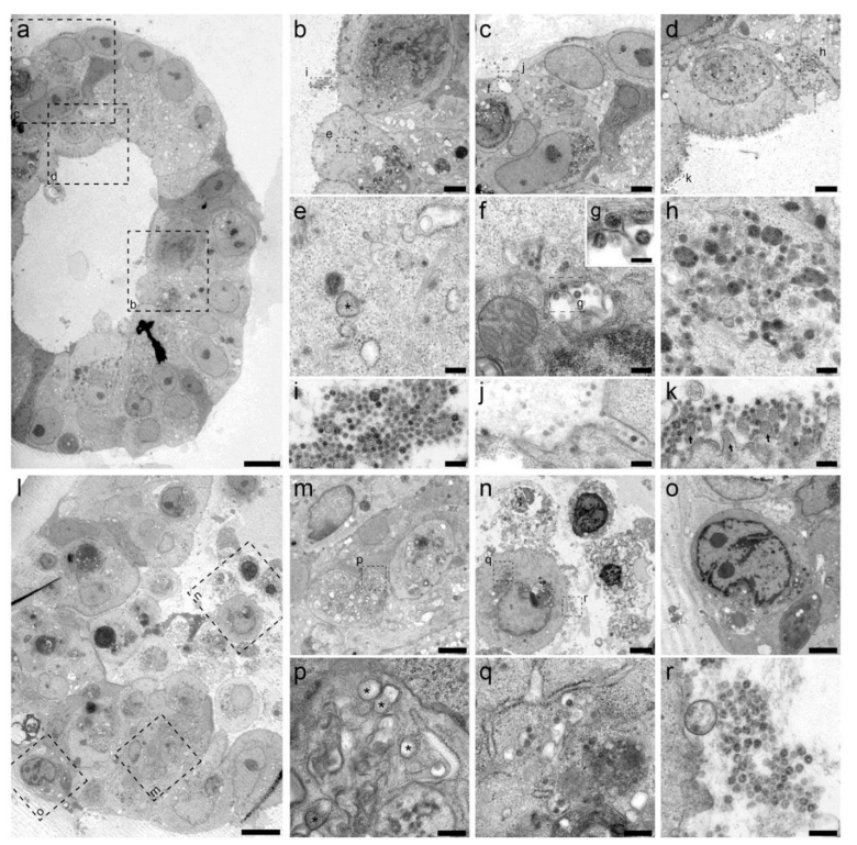 利用电镜技术,研究人员们看清了新冠病毒在肠上皮细胞中的生命周期
