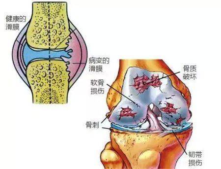 長期保持一個姿勢,慢慢會感覺髖關節有疼痛的感覺,有的時候走路會出現