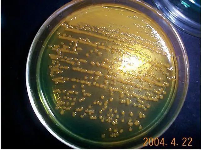 病原體:嗜水氣單胞桿菌,繼發性或者原發性的弧菌感染病蝦攝食減慢甚至