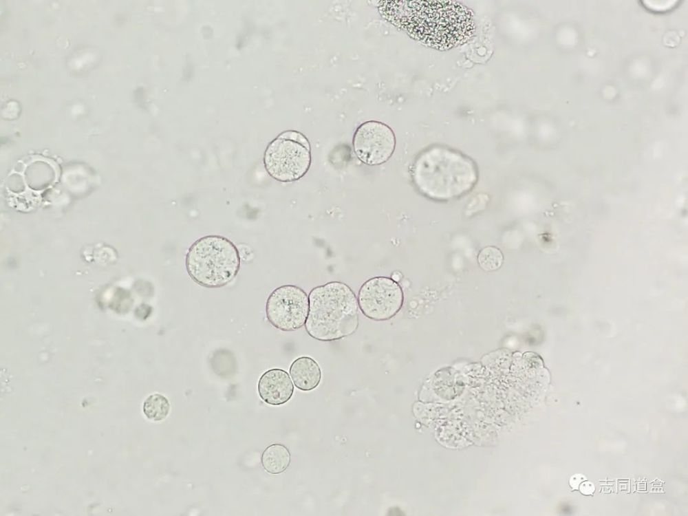 粪便吞噬细胞图片图片