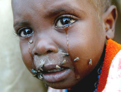 你是在度假还是在旅行看着那些小孩满身都是苍蝇你作何感想