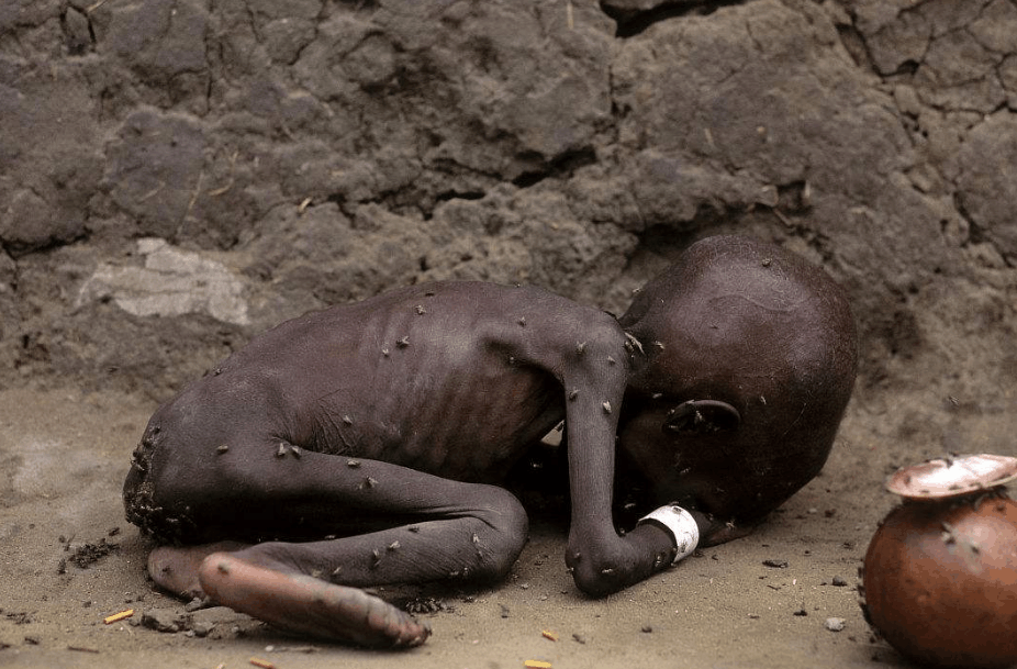 看着那些小孩满身都是苍蝇,你作何感想?