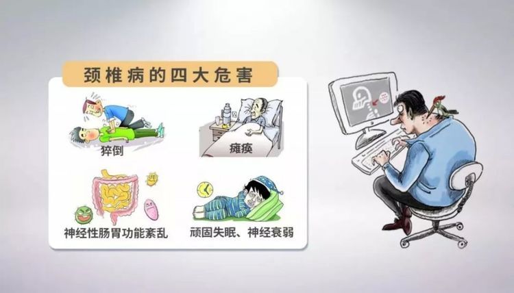 表姐颈椎病5年了 针灸吃药效果都不佳 最后竟用 这 方子好了 腾讯新闻