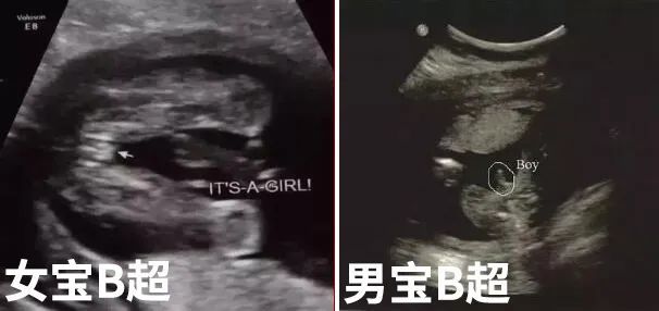 春晚说马丽要生儿子的人 看你猜对了吗 腾讯新闻