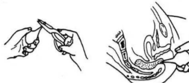 开塞露可以美容?看到这里来_腾讯新闻