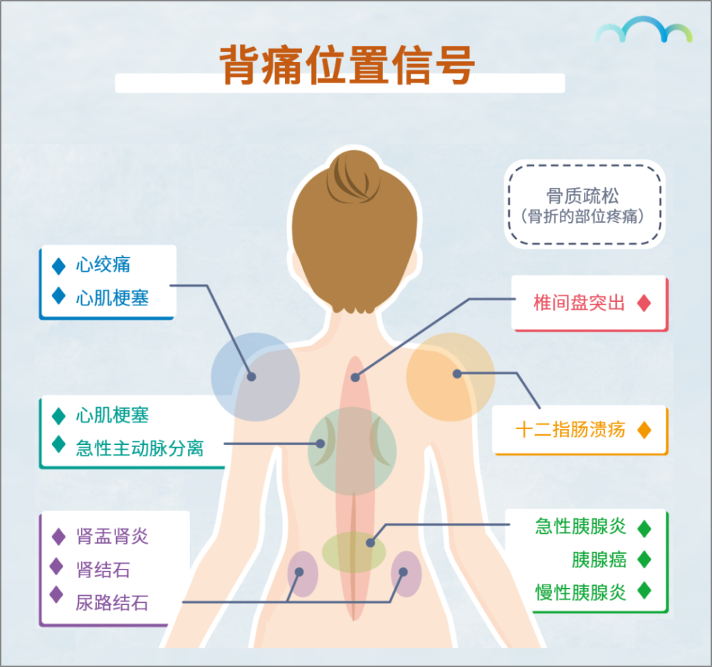 酸漲的痛覺時,可以對照一下圖中的部位,注意一下自己的疼痛位置以及