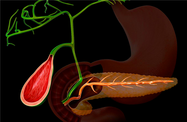 胆囊切除对人体有什么影响?医生直言:的确会落下2个"后遗症"