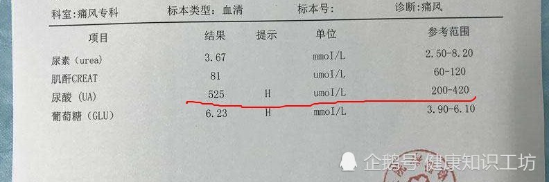 关节疼痛 尿酸升高 要警惕 你可能患上了痛风 腾讯新闻