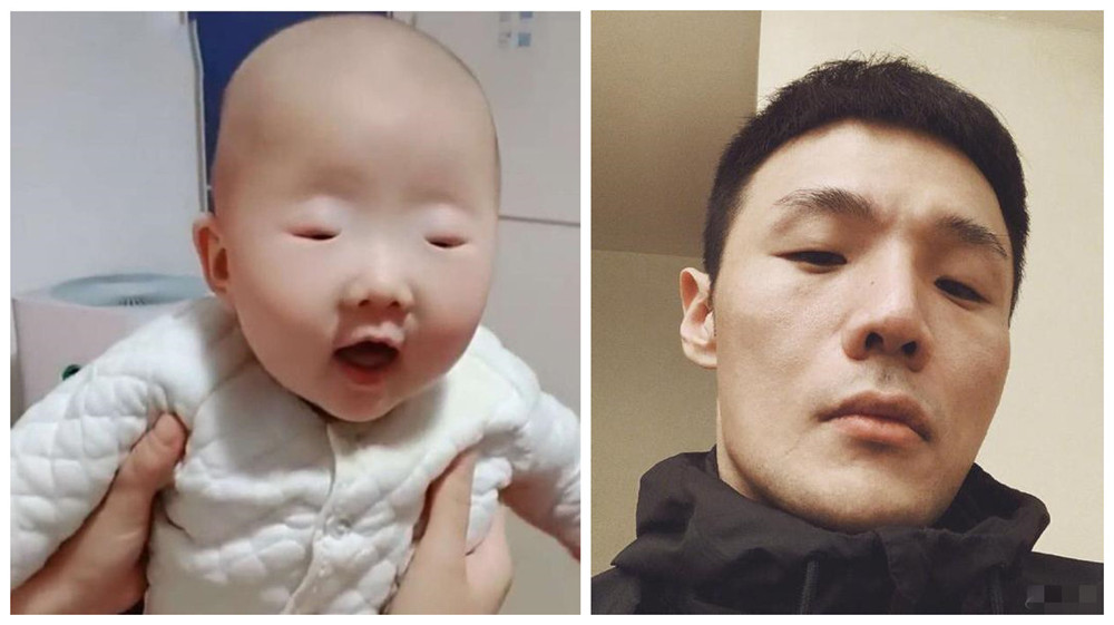 "最小眼睛宝宝"走红,医生称孩子视力健康,李荣浩莫名被点名_腾讯新闻
