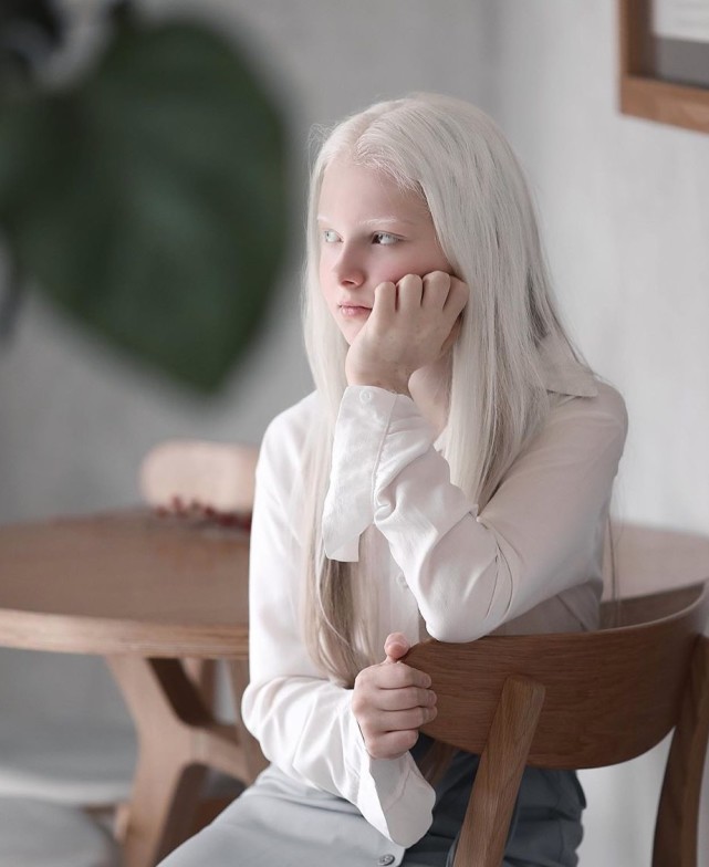 俄罗斯白化病瞳孔异色症少女照片惊艳网络,网友称她的美超凡脱俗