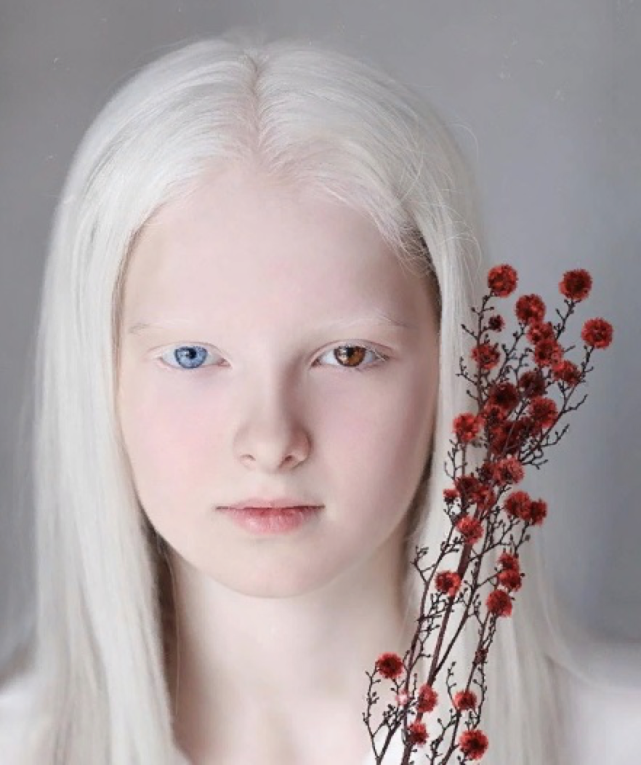 俄罗斯白化病瞳孔异色症少女照片惊艳网络,网友称她的美超凡脱俗