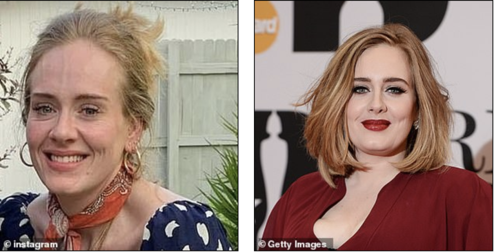 阿黛尔分享新照减重90斤后如同换了个人,专家断定她做了医美