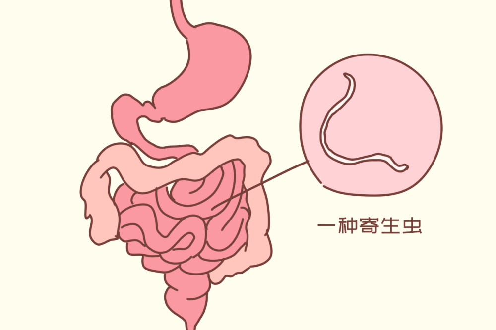 肠道蛔虫症图片