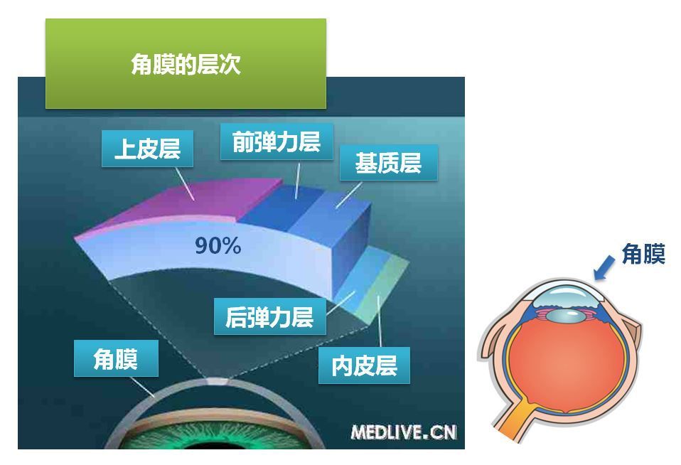 角膜,从外到内分为5层:上皮细胞层,前弹力层,基质层,后弹力层及内皮