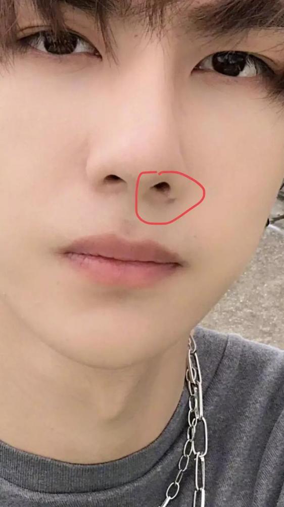 王一博鼻子有疤痕疑似整容?这么明显的痕迹他算圈内头一个!