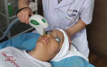 光子嫩肤是什么它有什么作用