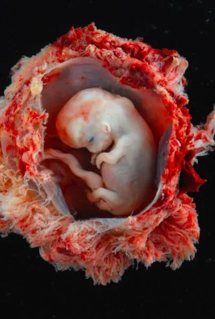 我们就不叫「胚胎」 而是真正意义上的胎儿了 在妈妈肚子里的第 8 周