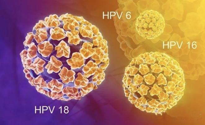 宮頸癌是婦女常見的惡性腫瘤,也是唯一病因明確的癌症—hpv感染,99%的