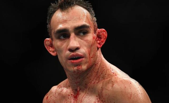 这就是王者夜魔-托尼·弗格森!