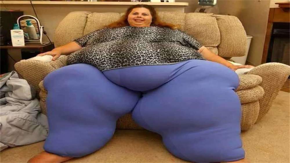 世界上最胖的人的照片图片