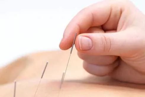 针灸一个点,刮痧一条线,迎伊嘉细胞激活仪一吹一大片