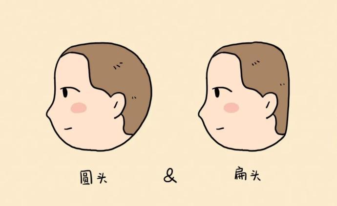 老人都喜欢让孩子睡扁头,但父母千万别让,看看扁头有多丑
