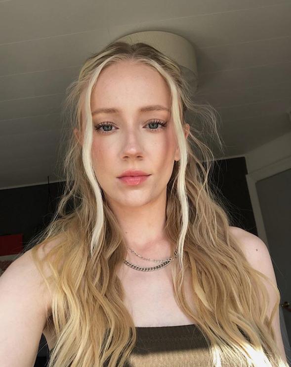 20岁"丹麦天使"脸崩了?