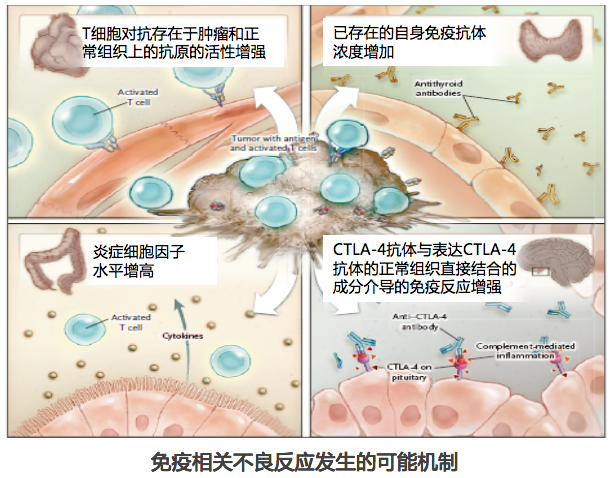 王孟昭免疫新时代irae的特点及管理原则