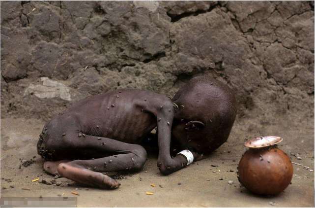 非洲小孩饥饿图片