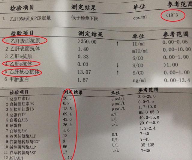 通常指的是乙肝表面的抗体,e抗体以及核心抗体阳性,而乙肝表面的抗原