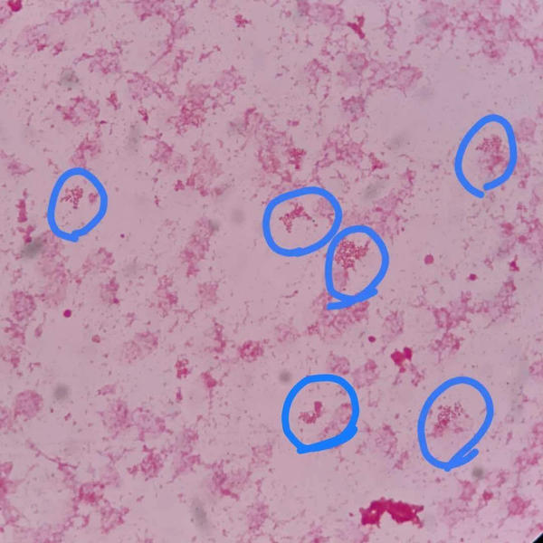 血培养中找到的布鲁氏菌