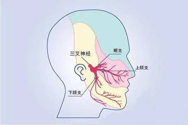 有种撕心裂肺叫做三叉神经痛别再当作牙痛治了