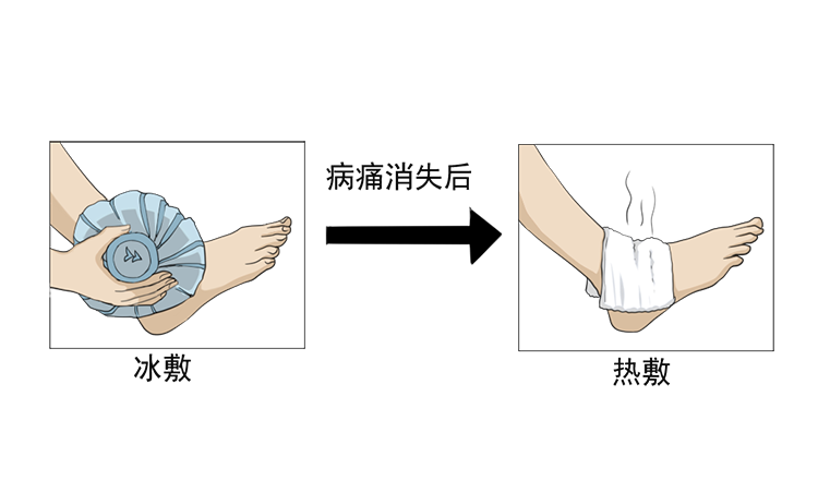 脚踝疼痛怎么办 牢记这4点很关键 帮你缓解疼痛 不留后遗症 腾讯新闻