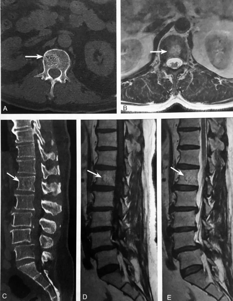 20个骨关节影像征象,总有一个你没见过!