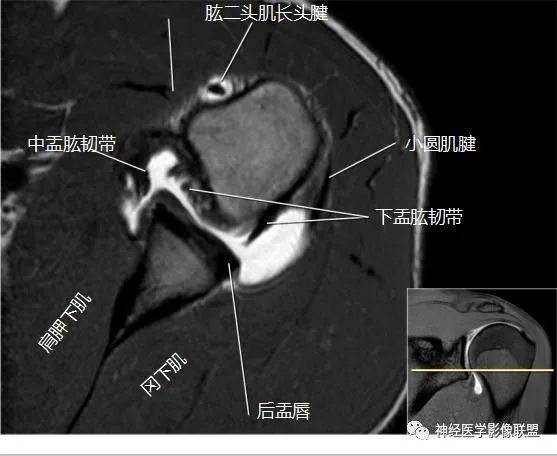 橫軸位肩關節解剖正常肘關節橫斷位mri3正常肘關節矢狀位mri2肘關節