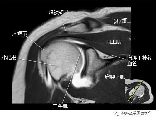 關於膝關節骨病踝關節及足解剖文中圖片可點擊後放大查看mr斷面解剖矢