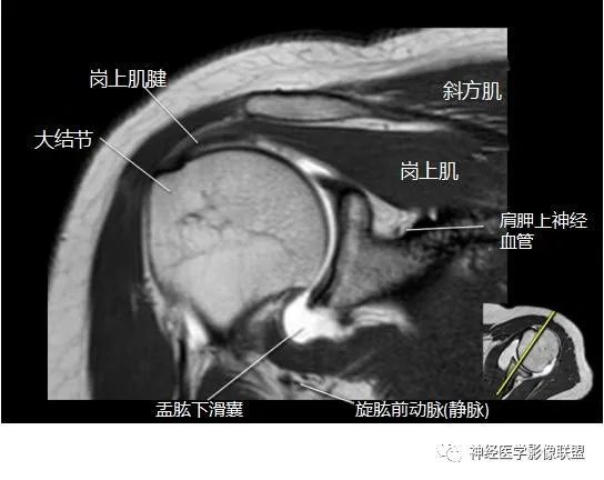 關於膝關節骨病踝關節及足解剖文中圖片可點擊後放大查看mr斷面解剖矢