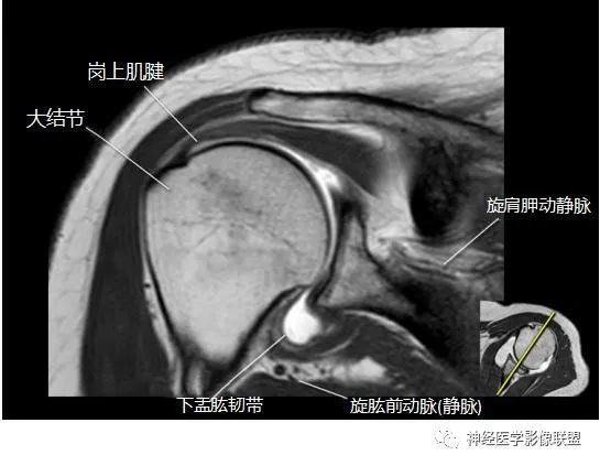 矢狀位髖關節解剖膝關節解剖矢狀mri解剖各類示意圖(便於理解)關於膝