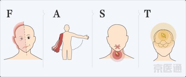 头晕|世纪坛专家：头晕、走路像踩棉花是怎么回事？