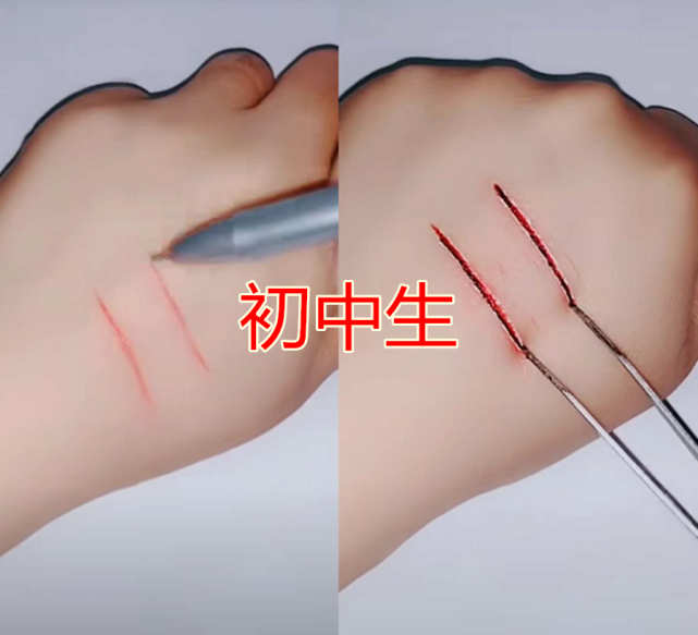 可以看到这个小学生画的这一个伤口比较变得简单了,首先画了一个十字