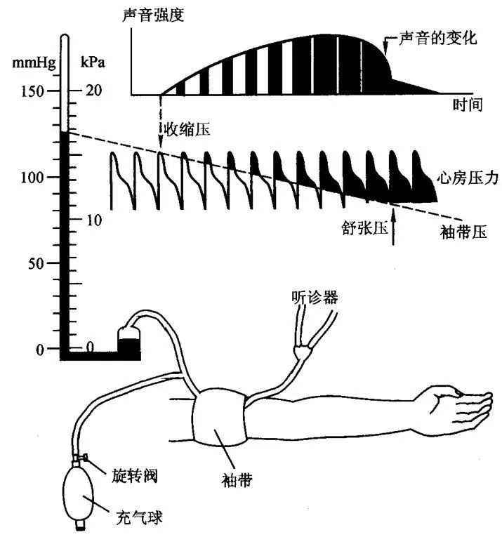 水银血压计使用的是柯氏音测量原理2水银血压计和电子血压计的测量