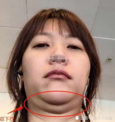脸只会越来越大,有"双下巴"也正常!